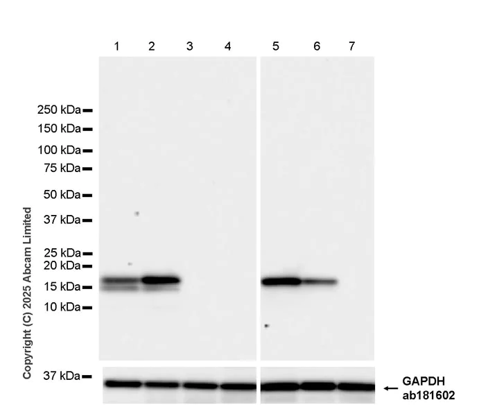 Western blot - Anti-TIPE2 antibody [EPR27964-44] (AB324268)