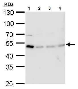 Western blot - Anti-TIPIN antibody (AB229329)