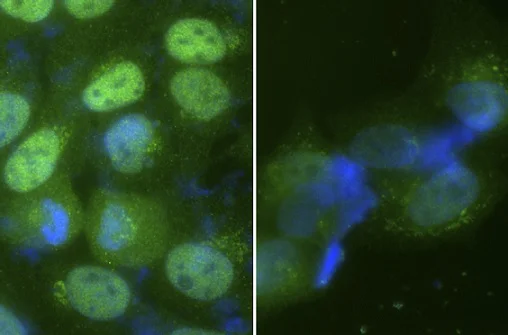 Immunocytochemistry/ Immunofluorescence - Anti-TIPIN antibody (AB236451)