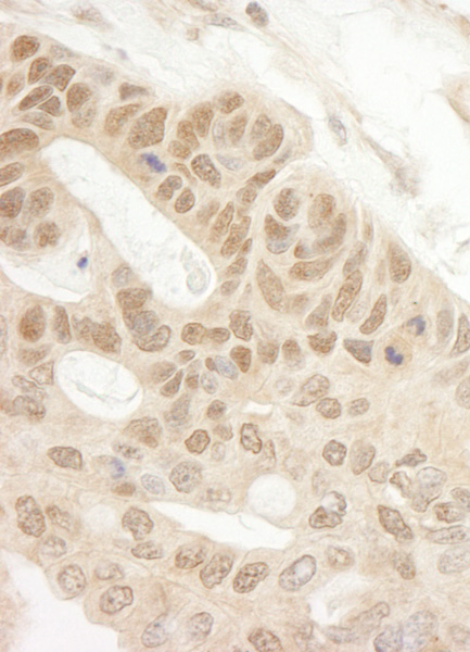 Immunohistochemistry (Formalin/PFA-fixed paraffin-embedded sections) - Anti-TIPRL antibody (AB70795)