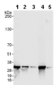 Western blot - Anti-TIPRL antibody (AB70795)