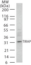 Western blot - Anti-TIRAP antibody [20D1055] (AB13684)