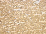 Immunohistochemistry (Formalin/PFA-fixed paraffin-embedded sections) - Anti-TIRAP antibody (AB17218)