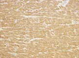 Immunohistochemistry (Formalin/PFA-fixed paraffin-embedded sections) - Anti-TIRAP antibody (AB17218)