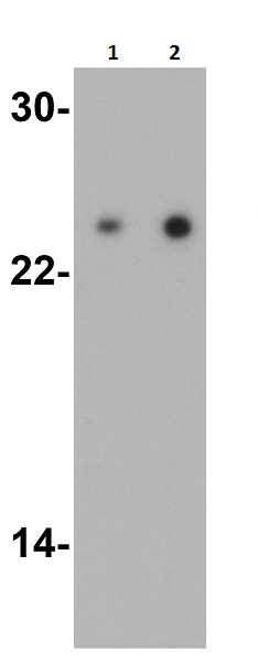 Anti-TIRAP antibody