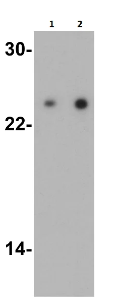 Western blot - Anti-TIRAP antibody (AB17218)