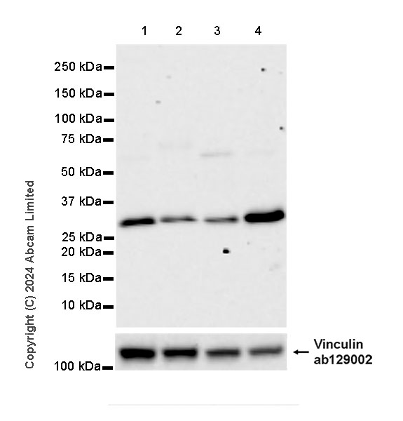 Western blot - Anti-TIRAP antibody [EPR27962-49] (AB319144), expandable thumbnail