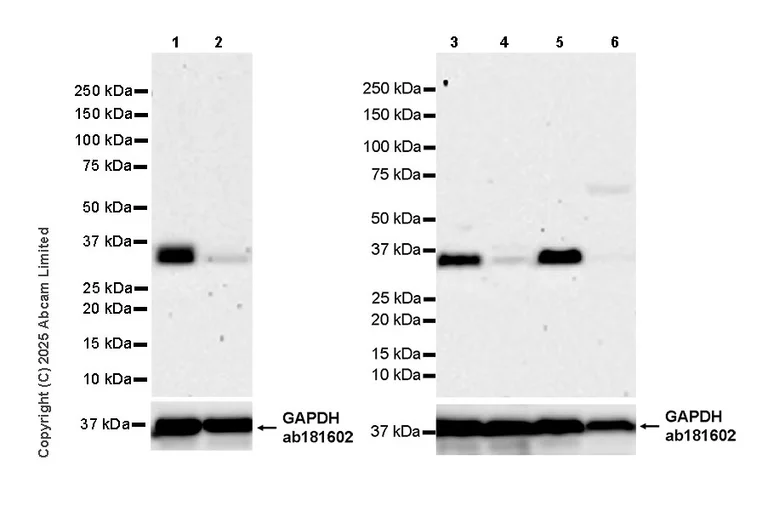 Western blot - Anti-TIRAP antibody [EPR30562-516] (AB325527)