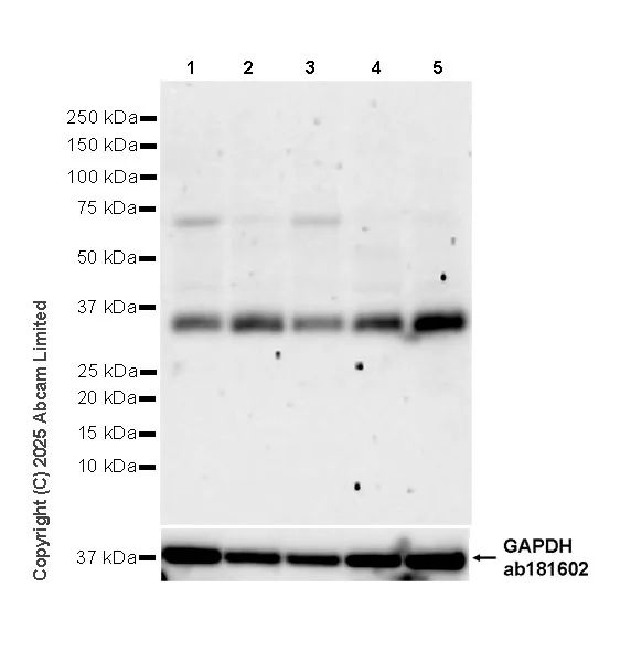 Western blot - Anti-TIRAP antibody [EPR30562-516] (AB325527)
