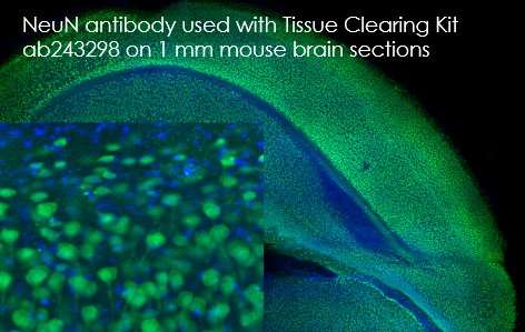 Immunohistochemistry (PFA fixed) - Tissue Clearing Kit  - hydrophobic (AB243298), expandable thumbnail