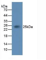 Western blot - Anti-Tissue Factor antibody [C5] (AB239521)