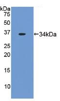 Western blot - Anti-Tissue Factor antibody [C5] (AB239521)