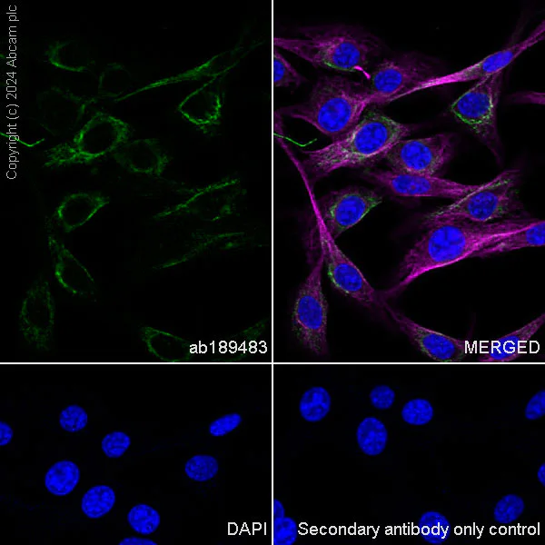 Immunocytochemistry/ Immunofluorescence - Anti-Tissue Factor antibody [EPR18160-175] - BSA and Azide free (AB227910)