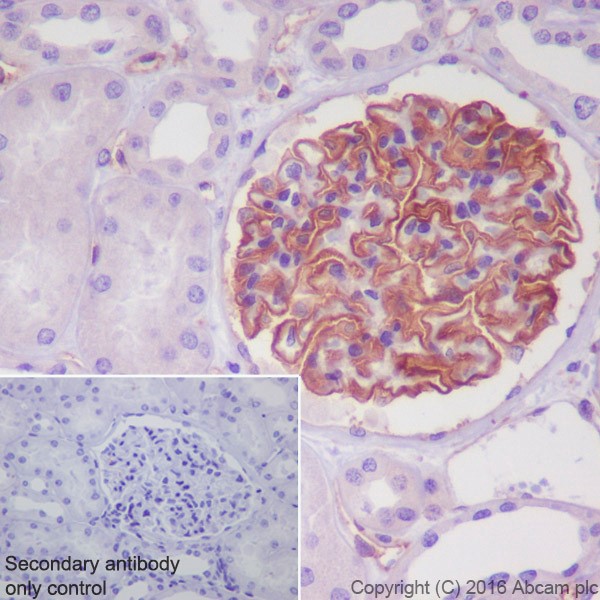 Immunohistochemistry (Formalin/PFA-fixed paraffin-embedded sections) - Anti-Tissue Factor antibody [EPR20369] - BSA and Azide free (AB242432), expandable thumbnail