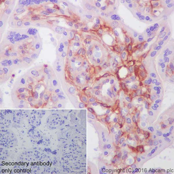 Immunohistochemistry (Formalin/PFA-fixed paraffin-embedded sections) - Anti-Tissue Factor antibody [EPR20369] - BSA and Azide free (AB242432), expandable thumbnail