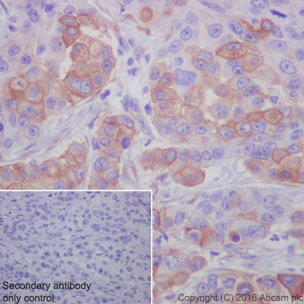 Immunohistochemistry (Formalin/PFA-fixed paraffin-embedded sections) - Anti-Tissue Factor antibody [EPR20369] - BSA and Azide free (AB242432), expandable thumbnail
