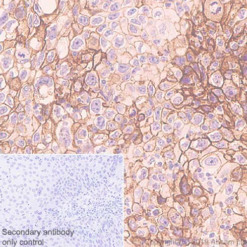 Immunohistochemistry (Formalin/PFA-fixed paraffin-embedded sections) - Anti-Tissue Factor antibody [EPR22548-232] - BSA and Azide free (AB254010)