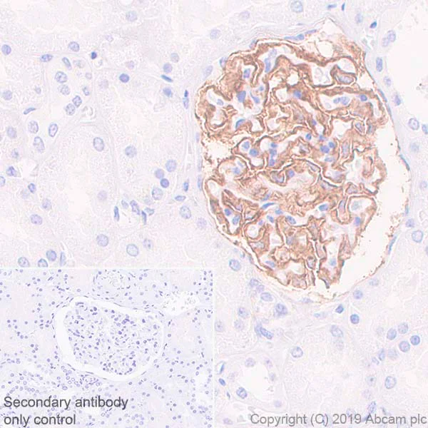 Immunohistochemistry (Formalin/PFA-fixed paraffin-embedded sections) - Anti-Tissue Factor antibody [EPR22548-232] - BSA and Azide free (AB254010)