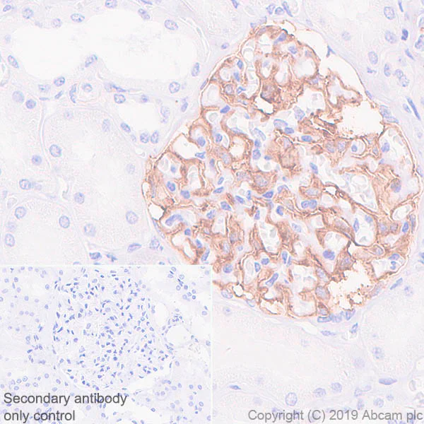 Immunohistochemistry (Formalin/PFA-fixed paraffin-embedded sections) - Anti-Tissue Factor antibody [EPR22548-240] - BSA and Azide free (AB254007)