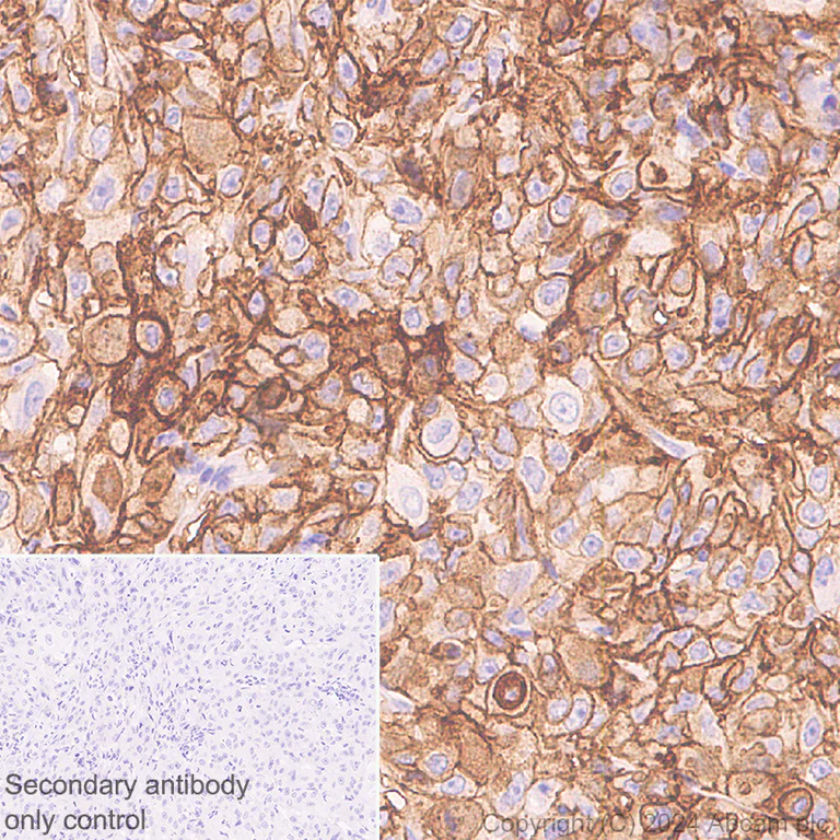Immunohistochemistry (Formalin/PFA-fixed paraffin-embedded sections) - Anti-Tissue Factor antibody [RM1198] (AB318995)