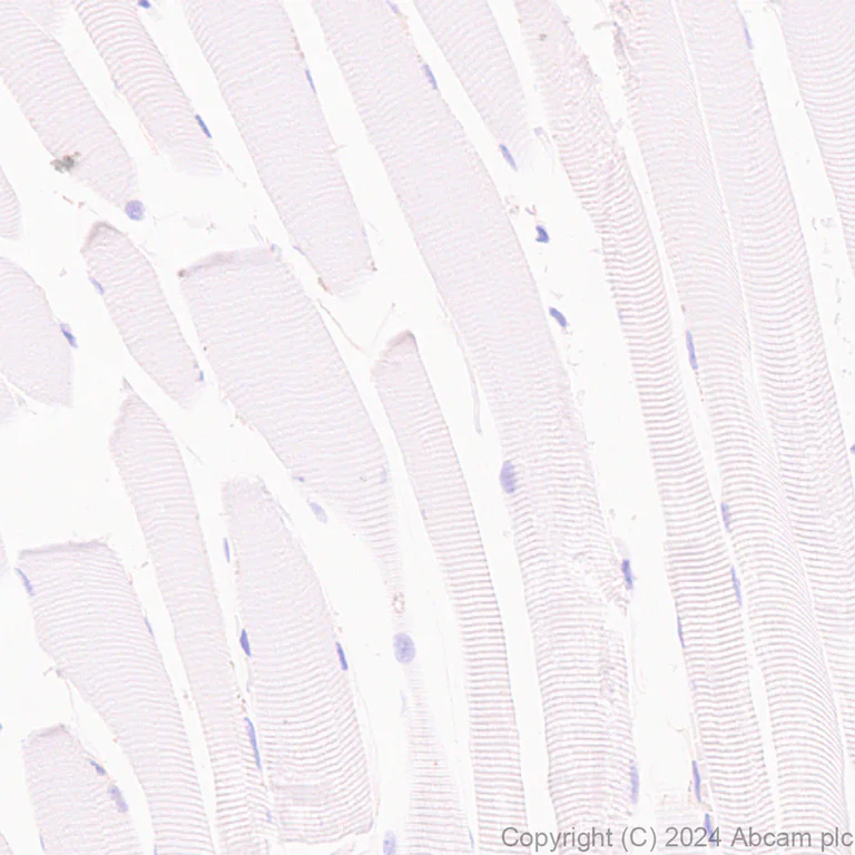 Immunohistochemistry (Formalin/PFA-fixed paraffin-embedded sections) - Anti-Tissue Factor antibody [RM1198] (AB318995)