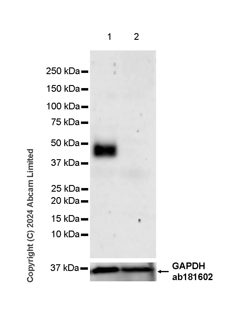 Western blot - Anti-Tissue Factor antibody [RM1198] (AB318995)