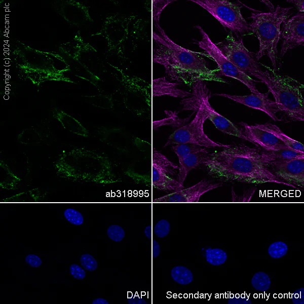 Immunocytochemistry/ Immunofluorescence - Anti-Tissue Factor antibody [RM1198] - BSA and Azide free (AB318996)