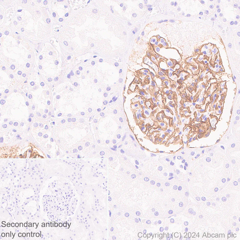 Immunohistochemistry (Formalin/PFA-fixed paraffin-embedded sections) - Anti-Tissue Factor antibody [RM1198] - BSA and Azide free (AB318996)