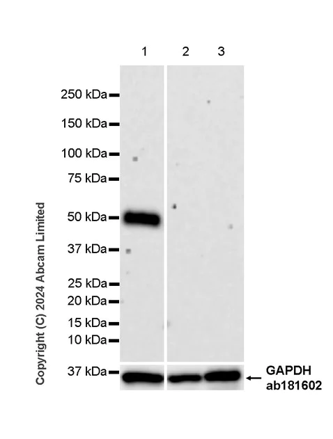 Western blot - Anti-Tissue Factor antibody [RM1198] - BSA and Azide free (AB318996)