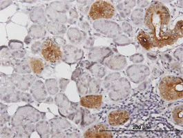 Immunohistochemistry (Formalin/PFA-fixed paraffin-embedded sections) - Anti-Tissue kallikrein antibody (AB169291)