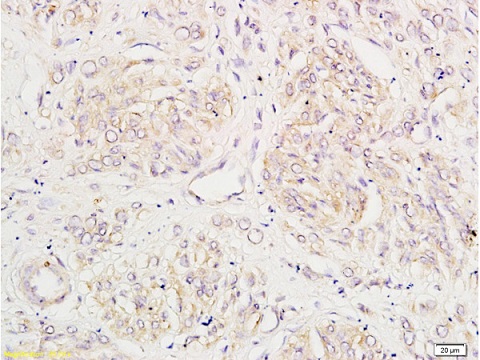 Immunohistochemistry (Formalin/PFA-fixed paraffin-embedded sections) - Anti-Tissue kallikrein antibody (AB217203)