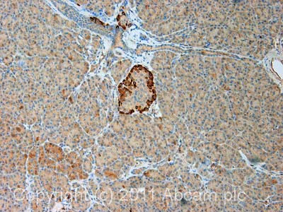 Immunohistochemistry (Formalin/PFA-fixed paraffin-embedded sections) - Anti-Tissue kallikrein antibody (AB28289)