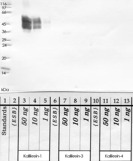 Western blot - Anti-Tissue kallikrein antibody (AB28289)