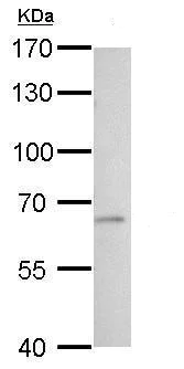 Western blot - Anti-Tissue Plasminogen Activator antibody (AB227069)