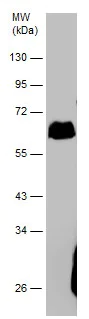 Western blot - Anti-Tissue Plasminogen Activator antibody (AB227069)