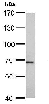 Western blot - Anti-Tissue Plasminogen Activator antibody (AB227069)