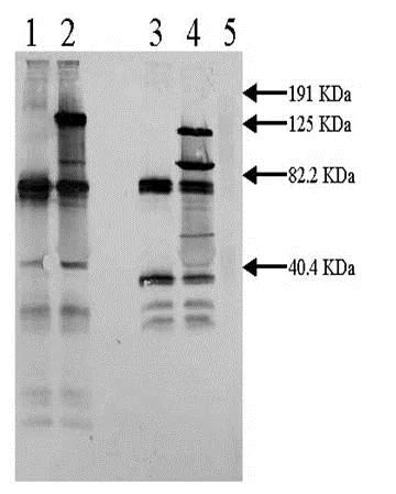 Western blot - Anti-Tissue Plasminogen Activator antibody (AB62763)