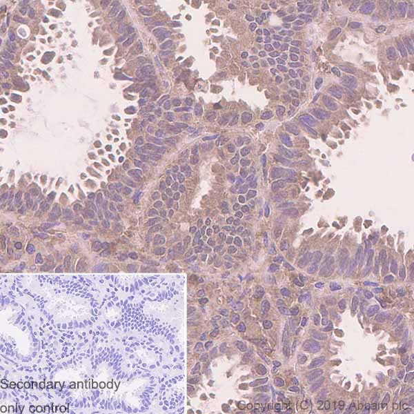 Immunohistochemistry (Formalin/PFA-fixed paraffin-embedded sections) - Anti-Tissue Plasminogen Activator antibody [EPR7232(2)] (AB157469), expandable thumbnail