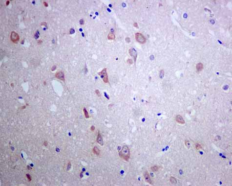 Immunohistochemistry (Formalin/PFA-fixed paraffin-embedded sections) - Anti-Tissue Plasminogen Activator antibody [EPR7232(2)] (ab157469), expandable thumbnail
