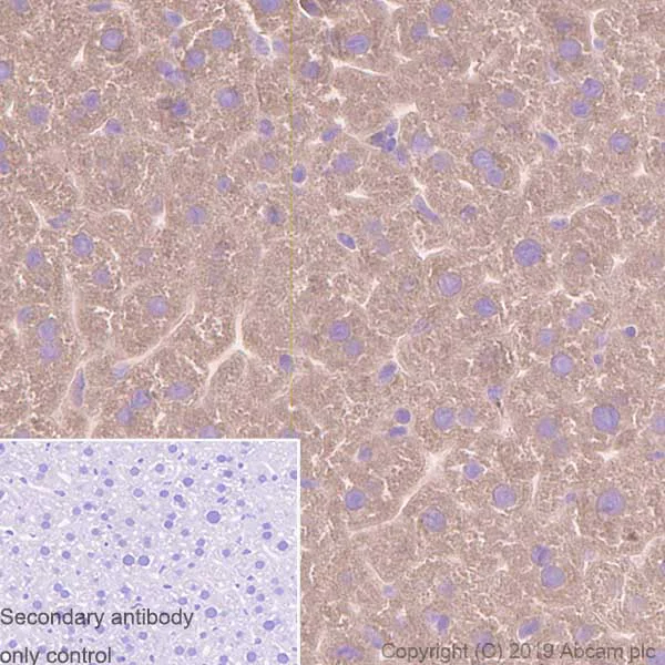 Immunohistochemistry (Formalin/PFA-fixed paraffin-embedded sections) - Anti-Tissue Plasminogen Activator antibody [EPR7232(2)] (AB157469)