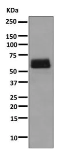 Western blot - Anti-Tissue Plasminogen Activator antibody [EPR7232(2)] (AB157469)