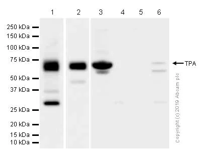 Western blot - Anti-Tissue Plasminogen Activator antibody [EPR7232(2)] (AB157469)