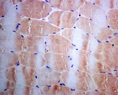 Immunohistochemistry (Formalin/PFA-fixed paraffin-embedded sections) - Anti-Tissue Plasminogen Activator antibody [EPR7232(2)] - BSA and Azide free (AB240146)