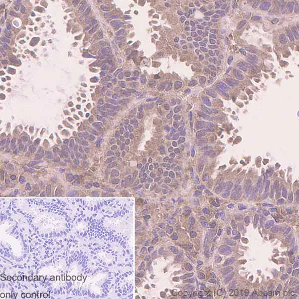 Immunohistochemistry (Formalin/PFA-fixed paraffin-embedded sections) - Anti-Tissue Plasminogen Activator antibody [EPR7232(2)] - BSA and Azide free (AB240146)