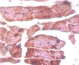 Immunohistochemistry (Formalin/PFA-fixed paraffin-embedded sections) - Anti-Titin antibody (AB193218)