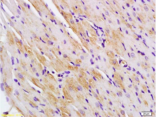 Immunohistochemistry (Formalin/PFA-fixed paraffin-embedded sections) - Anti-Titin antibody (AB203623)