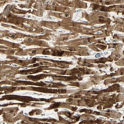 Immunohistochemistry (Formalin/PFA-fixed paraffin-embedded sections) - Anti-Titin antibody (AB224346), expandable thumbnail