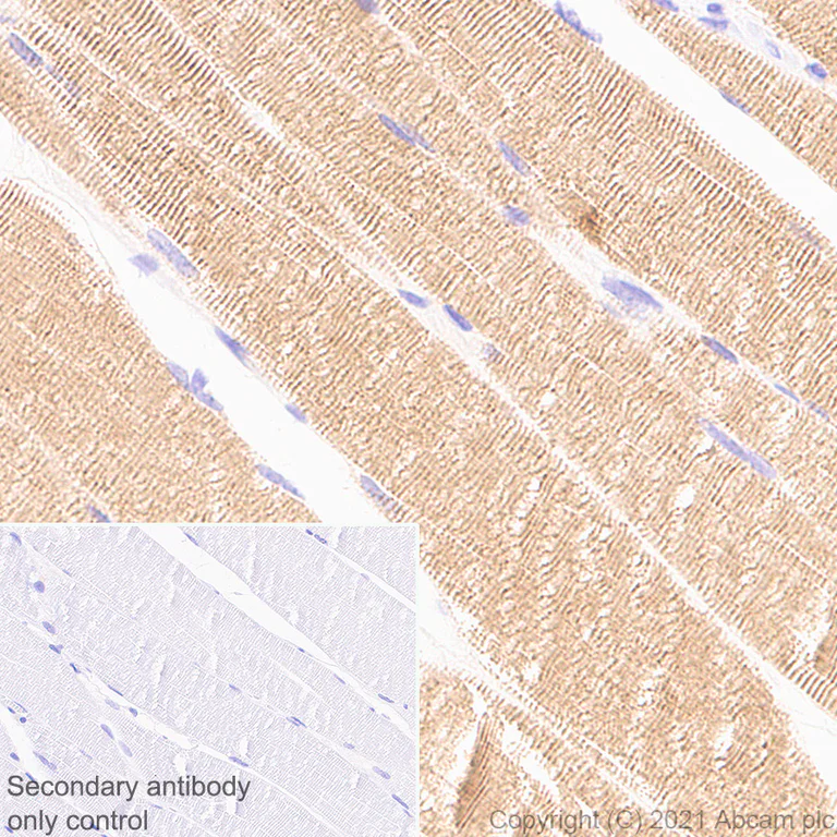 Immunohistochemistry (Formalin/PFA-fixed paraffin-embedded sections) - Anti-Titin antibody [EPR24455-21] (AB284860)