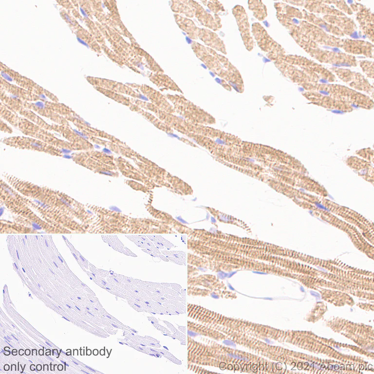 Immunohistochemistry (Formalin/PFA-fixed paraffin-embedded sections) - Anti-Titin antibody [EPR24455-21] (AB284860)