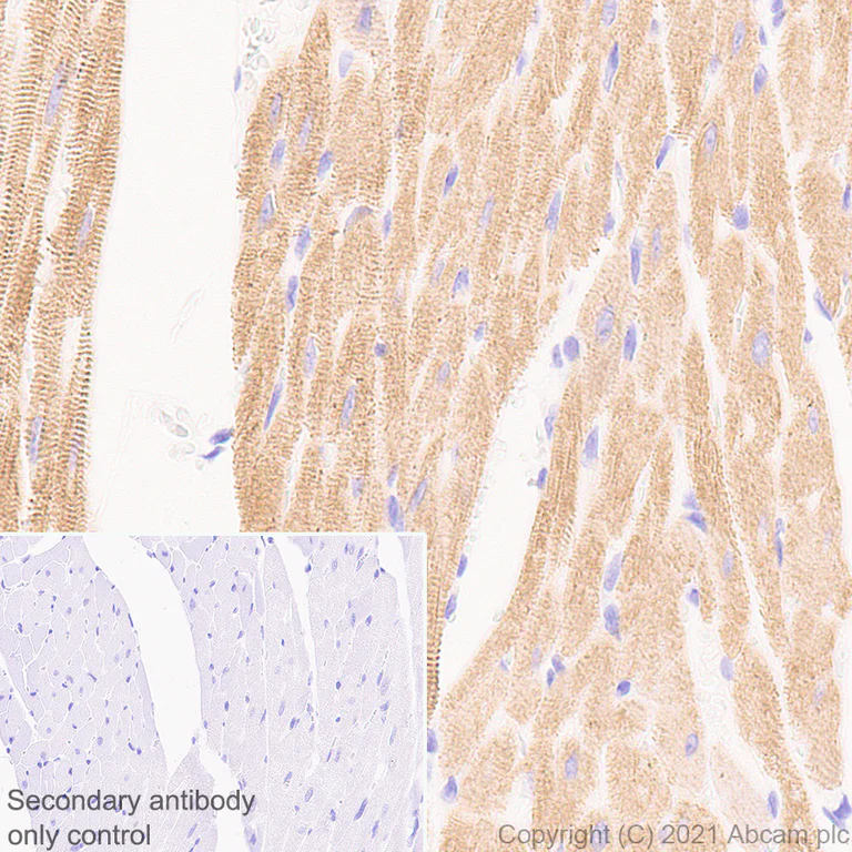 Immunohistochemistry (Formalin/PFA-fixed paraffin-embedded sections) - Anti-Titin antibody [EPR24455-21] (AB284860)